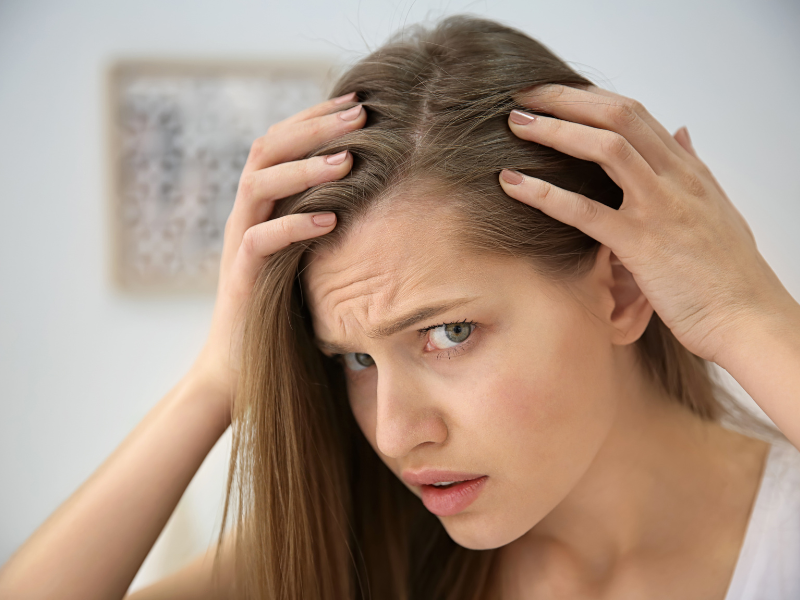 Frontal Fibrosing Alopecia