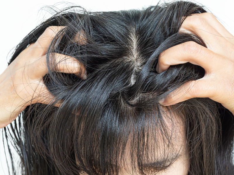 Lice
