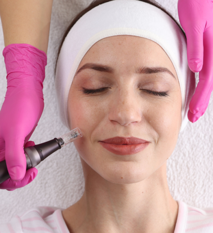 Microneedling-idh