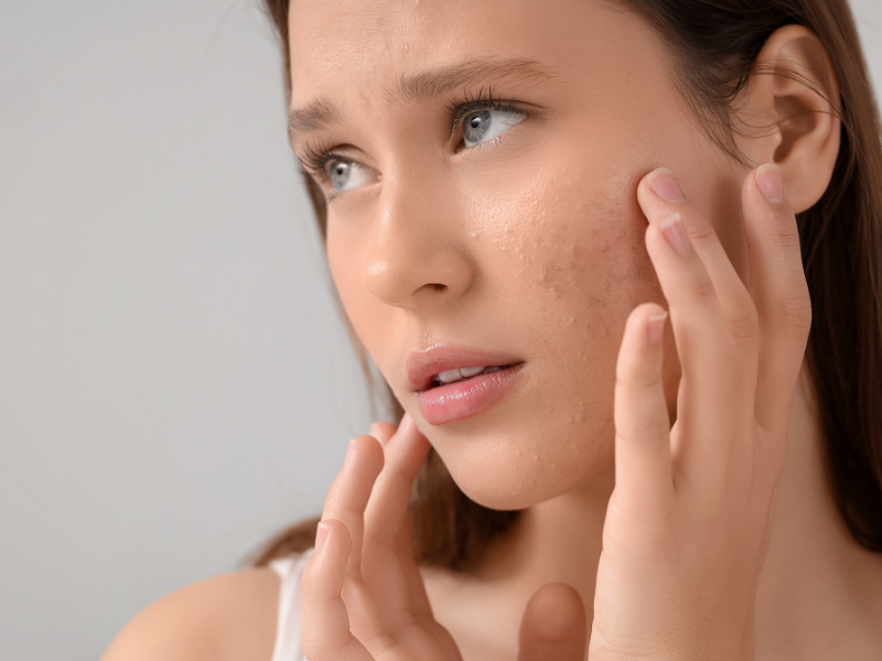 Skin Care for Dry, Sensitive Skin Types