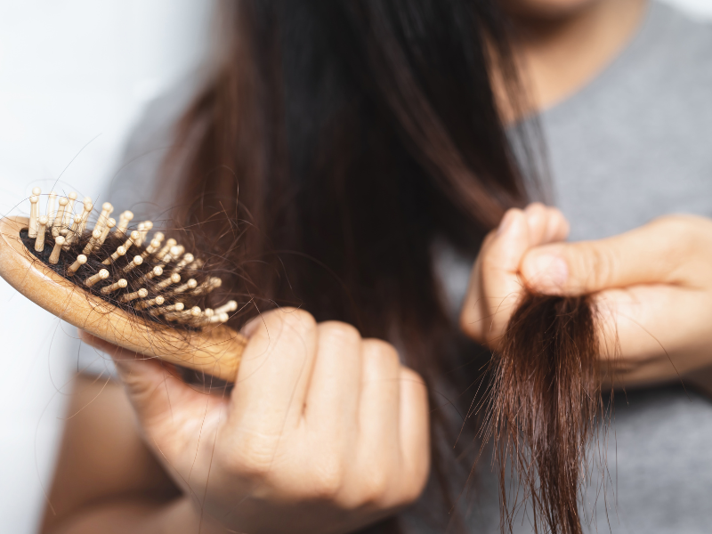 Hair Loss