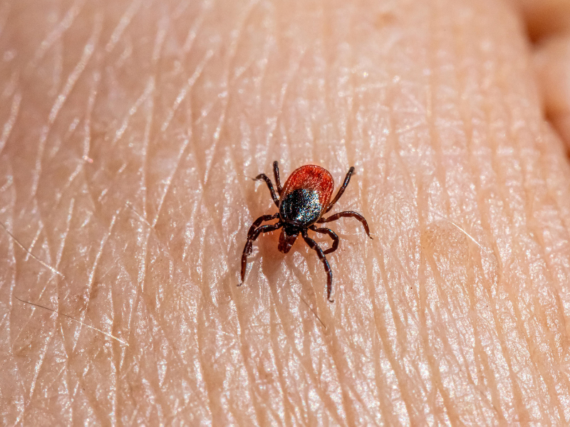 Lyme Disease