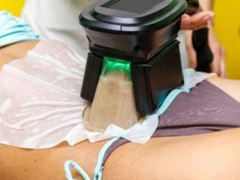Non Surgical Body Contouring