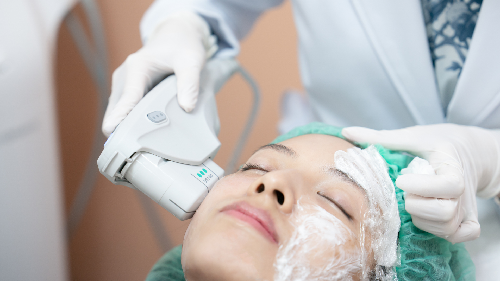 Ultherapy_1