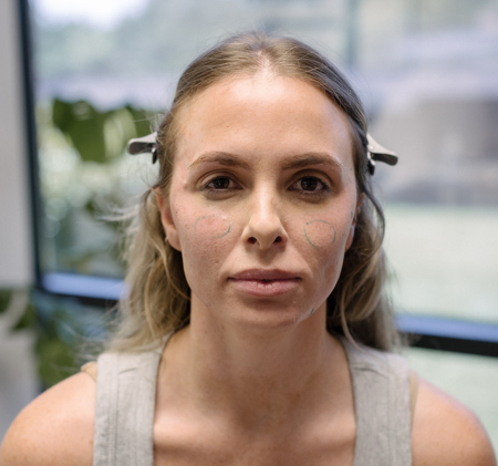 cosmetic-idh